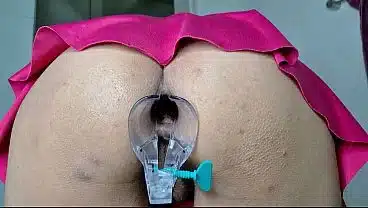 MILF Gape Anal Speculum Closeup