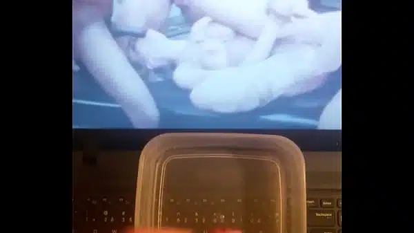 xx
